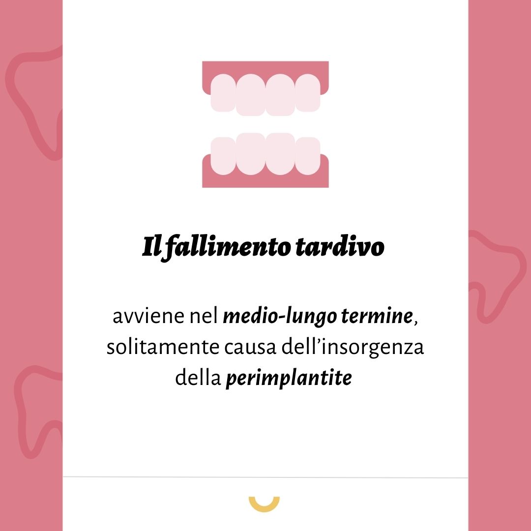 fallimento tardivo impianto dentale